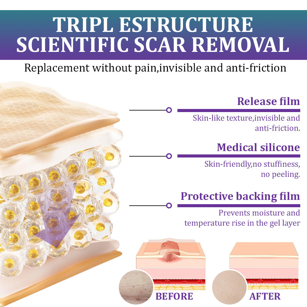 🏷️ Official Store: Flysmus® ReGen Hyaluronic Acid Nano-Heal Microneedle Tape - Treatment of old and new scars, reduction of surgical scars, stretch marks, keloids, acne, burns, warts, dermatomes and varicose veins
