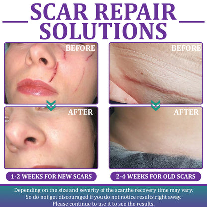 💝 Official Store: Flysmus® ReGen Hyaluronic Acid Nano-Heal Microneedle Tape - 🏷️Treatment of old and new scars, reduction of surgical scars, stretch marks, keloids, acne, burns, warts, dermatomes and varicose veins