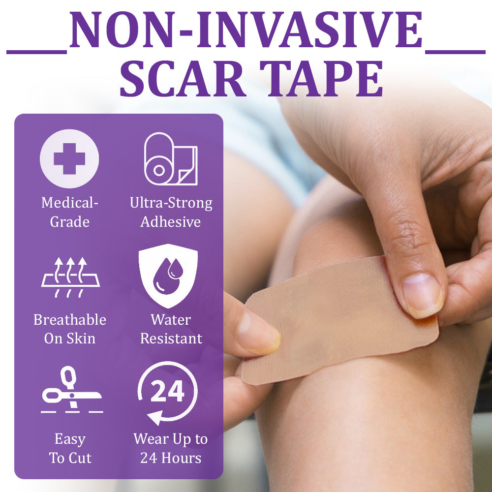 💝 Official Store: Flysmus® ReGen Hyaluronic Acid Nano-Heal Microneedle Tape - 🏷️Treatment of old and new scars, reduction of surgical scars, stretch marks, keloids, acne, burns, warts, dermatomes and varicose veins