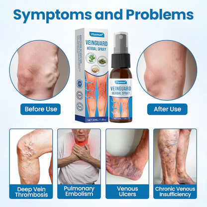 🌿𝐅𝐥𝐲𝐬𝐦𝐮𝐬® 𝐕𝐞𝐢𝐧𝐆𝐮𝐚𝐫𝐝 𝐇𝐞𝐫𝐛𝐚𝐥 𝐒𝐩𝐫𝐚𝐲 – For Healthy, Pain-Free Legs