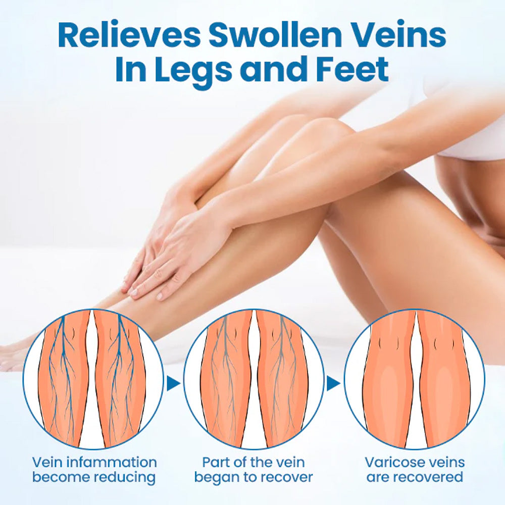 🌿𝐅𝐥𝐲𝐬𝐦𝐮𝐬® 𝐕𝐞𝐢𝐧𝐆𝐮𝐚𝐫𝐝 𝐇𝐞𝐫𝐛𝐚𝐥 𝐒𝐩𝐫𝐚𝐲 – For Healthy, Pain-Free Legs