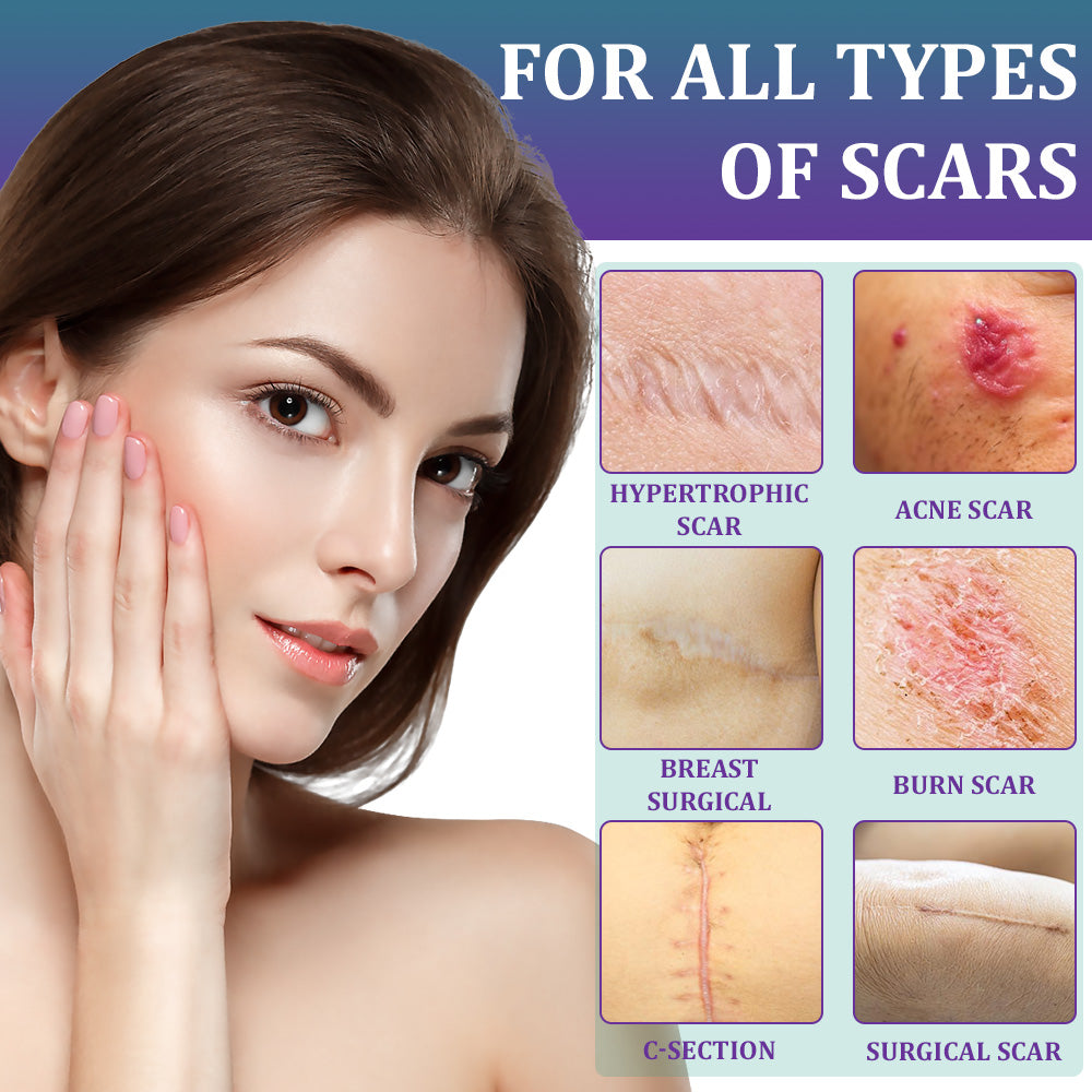 💝 Official Store: Flysmus® ReGen Hyaluronic Acid Nano-Heal Microneedle Tape - 🏷️Treatment of old and new scars, reduction of surgical scars, stretch marks, keloids, acne, burns, warts, dermatomes and varicose veins
