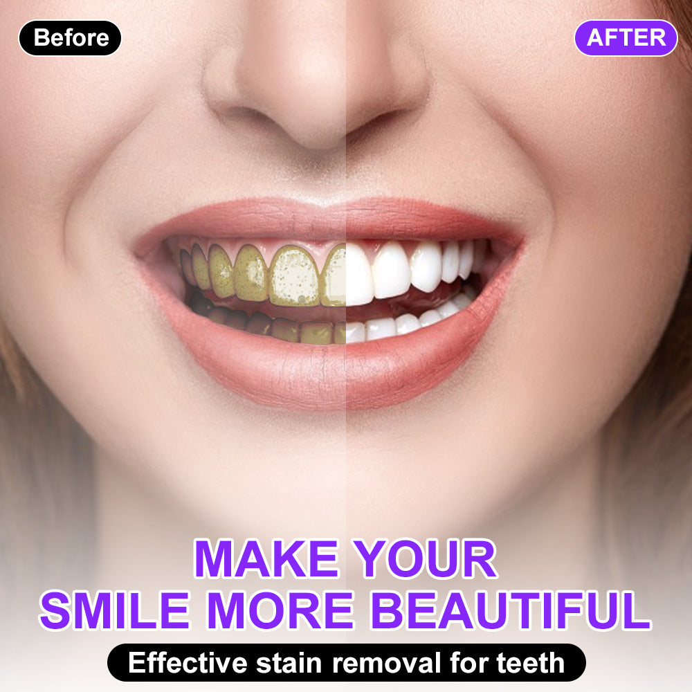 🦷💚𝐅𝐥𝐲𝐬𝐦𝐮𝐬® 𝐂𝐨𝐥𝐨𝐮𝐫 𝐂𝐨𝐫𝐫𝐞𝐜𝐭𝐨𝐫 𝐒𝐞𝐫𝐮𝐦 — safe for sensitive teeth and enamel