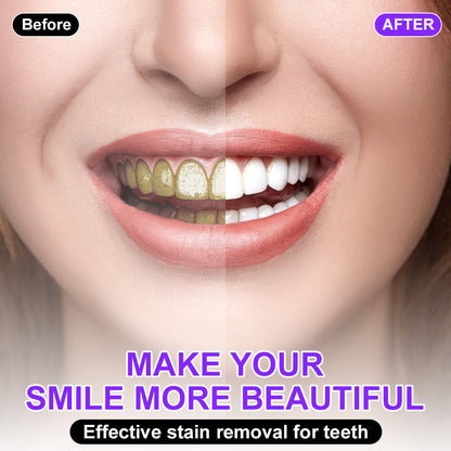 🦷💚𝐅𝐥𝐲𝐬𝐦𝐮𝐬® 𝐂𝐨𝐥𝐨𝐮𝐫 𝐂𝐨𝐫𝐫𝐞𝐜𝐭𝐨𝐫 𝐒𝐞𝐫𝐮𝐦 — safe for sensitive teeth and enamel