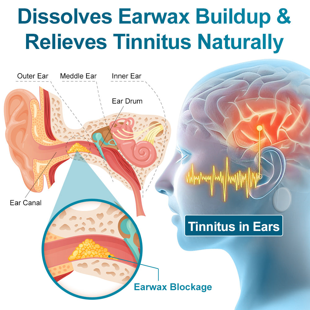 🍀🍀Zvoevo®EaseHear Instant Hearing Support & Tinnitus Relief Patches | Clinically tested & trusted by thousands for clearer, calmer hearing — (dizziness, nausea & cold sweats)