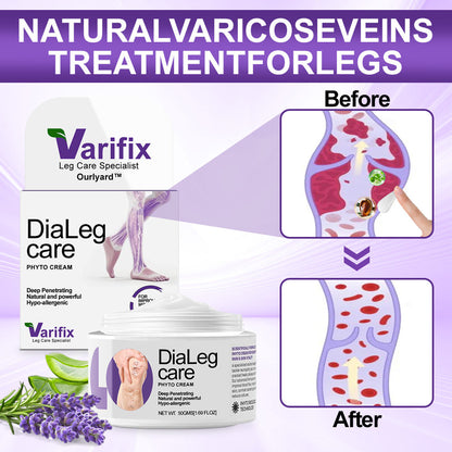 ✅🏆𝐎𝐮𝐫𝐥𝐲𝐚𝐫𝐝®𝐃𝐢𝐚𝐋𝐞𝐠 𝐂𝐚𝐫𝐞 𝐏𝐡𝐲𝐭𝐨 𝐂𝐫𝐞𝐚𝐦 - Helps Treat Varicose Veins, Swelling, Cramps, and Leg Pain