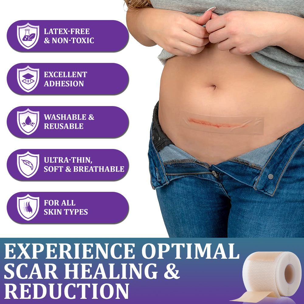 💝 Official Store: Flysmus® ReGen Hyaluronic Acid Nano-Heal Microneedle Tape - 🏷️Treatment of old and new scars, reduction of surgical scars, stretch marks, keloids, acne, burns, warts, dermatomes and varicose veins