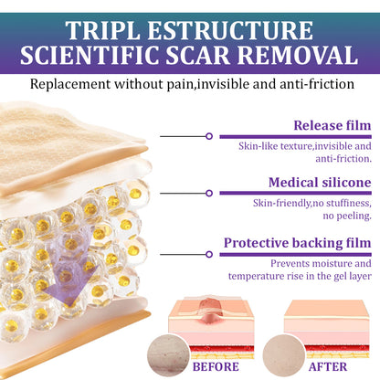 💝 Official Store: Flysmus® ReGen Hyaluronic Acid Nano-Heal Microneedle Tape - 🏷️Treatment of old and new scars, reduction of surgical scars, stretch marks, keloids, acne, burns, warts, dermatomes and varicose veins
