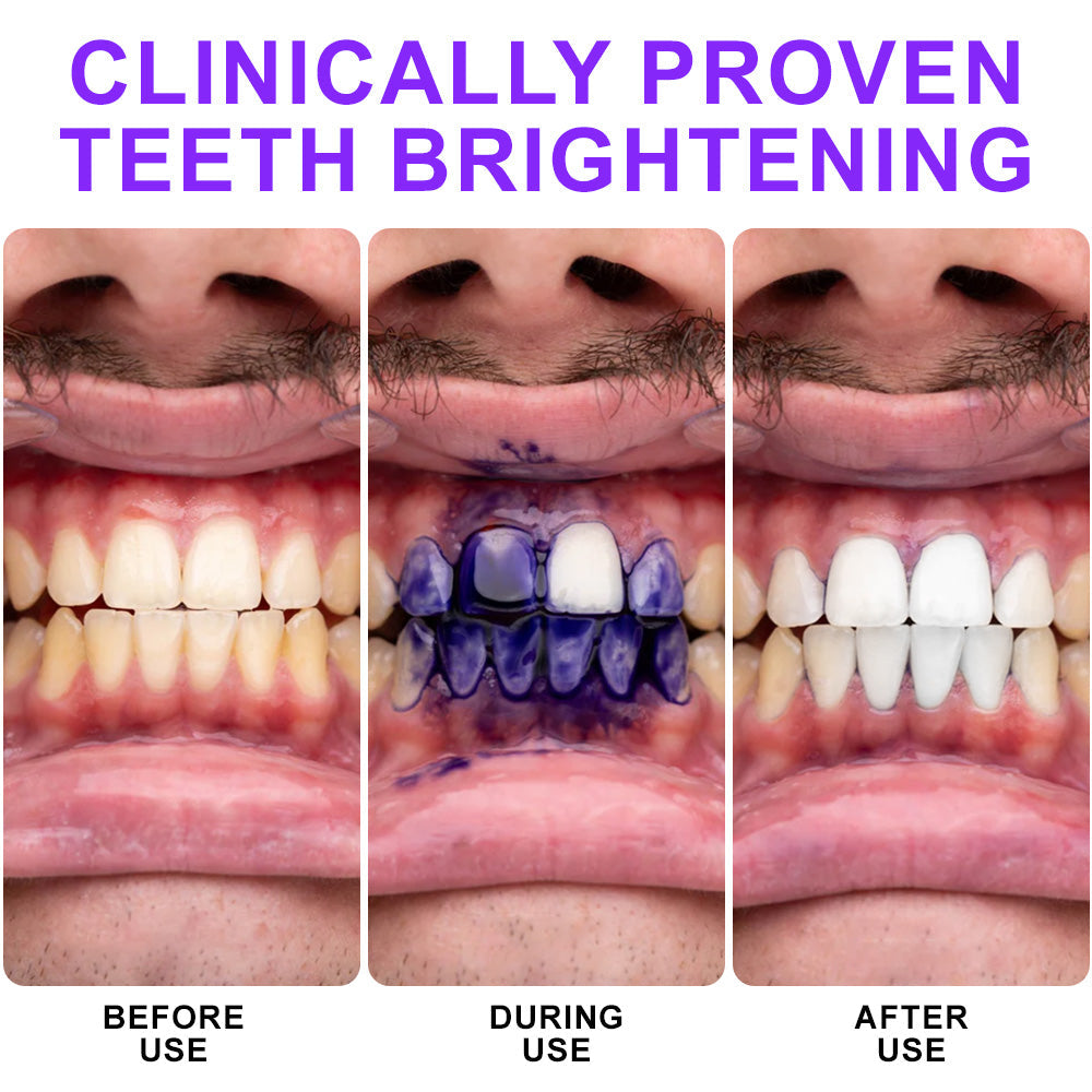🦷💚𝐅𝐥𝐲𝐬𝐦𝐮𝐬® 𝐂𝐨𝐥𝐨𝐮𝐫 𝐂𝐨𝐫𝐫𝐞𝐜𝐭𝐨𝐫 𝐒𝐞𝐫𝐮𝐦 — safe for sensitive teeth and enamel
